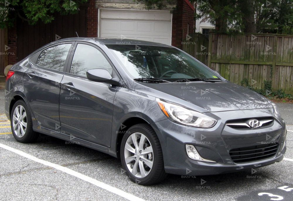 Ремонт охлаждения ДВС Hyundai Accent в Ростове-на-Дону